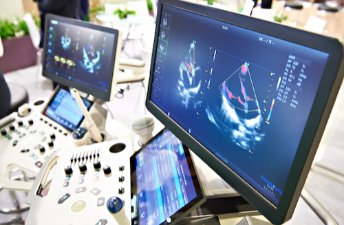 Ultrasound Imaging